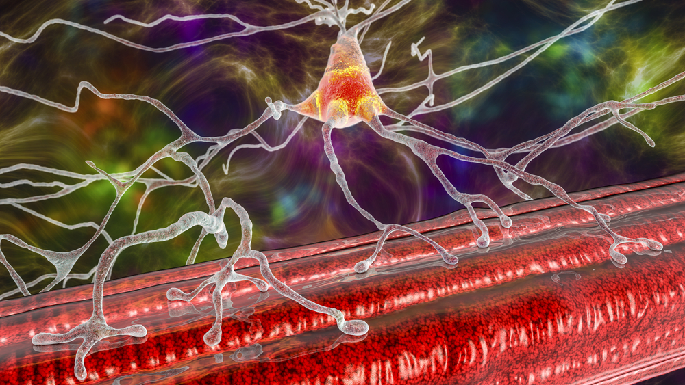 What Neuromuscular Disorder Causes Severe Skeletal Muscle Weakness