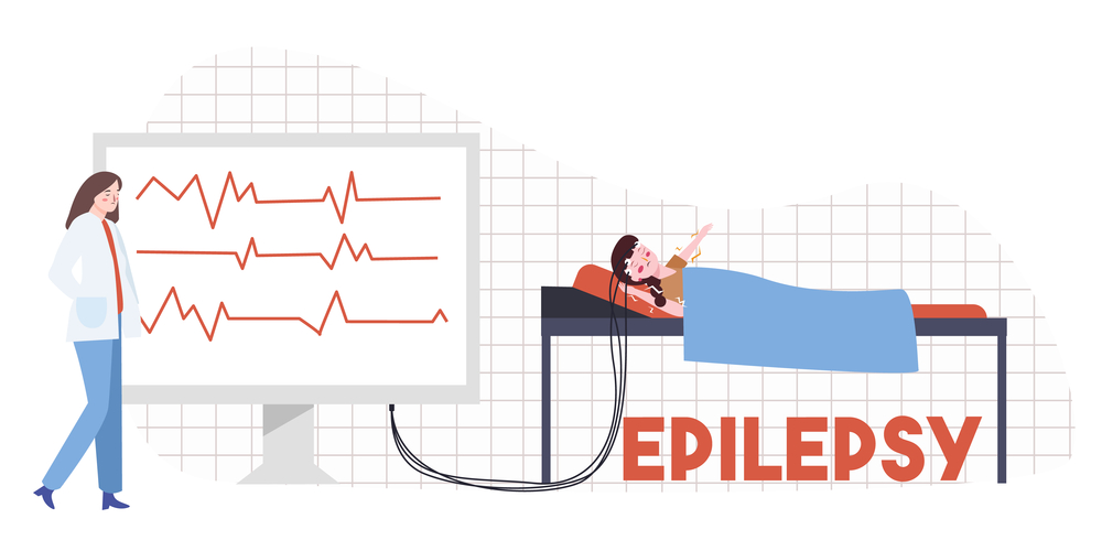 Illustration of epilepsy diagnosis